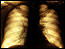 asthma.rs/respiratory.system