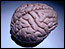 cancer/brain