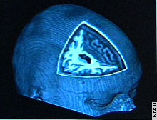A head for business? Some scientists say the secret to a good investor is all in the brain.