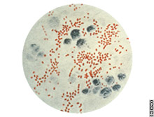 Plague still occurs in the United States, with about 10 to 20 cases reported each year.