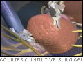 Building robot doctors